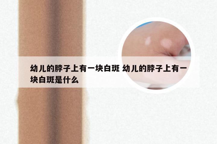 幼儿的脖子上有一块白斑 幼儿的脖子上有一块白斑是什么