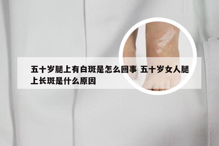 五十岁腿上有白斑是怎么回事 五十岁女人腿上长斑是什么原因