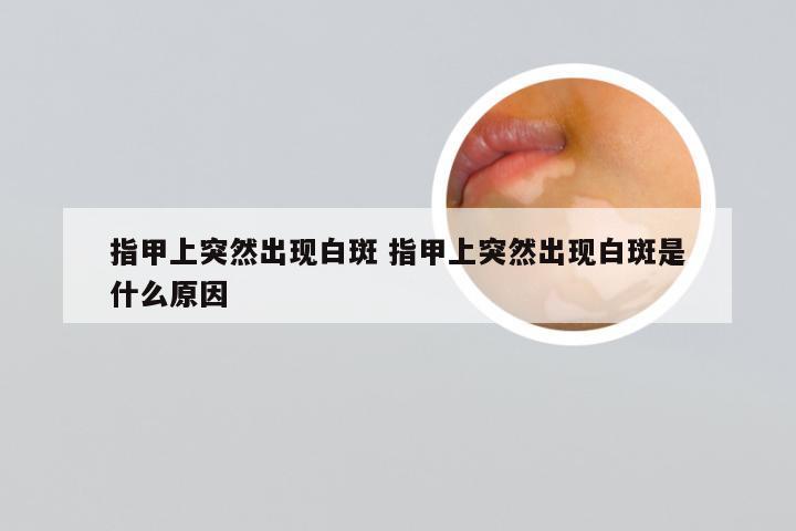 指甲上突然出现白斑 指甲上突然出现白斑是什么原因