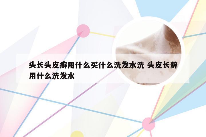 头长头皮癣用什么买什么洗发水洗 头皮长藓用什么洗发水
