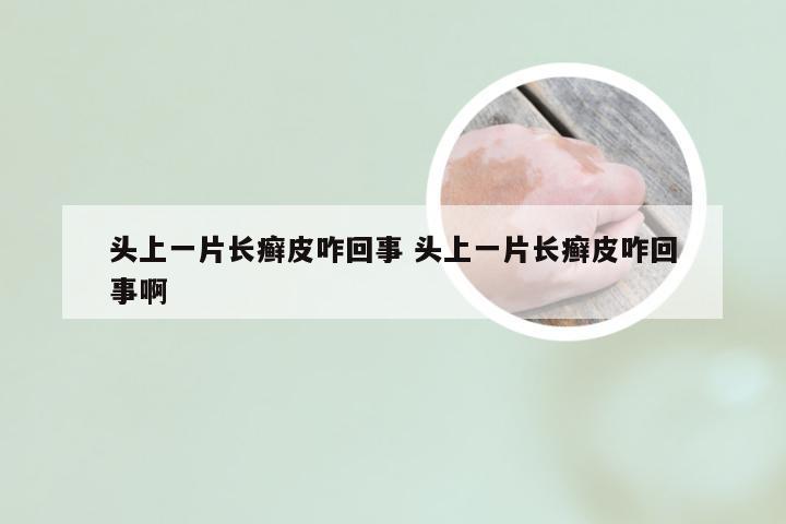 头上一片长癣皮咋回事 头上一片长癣皮咋回事啊