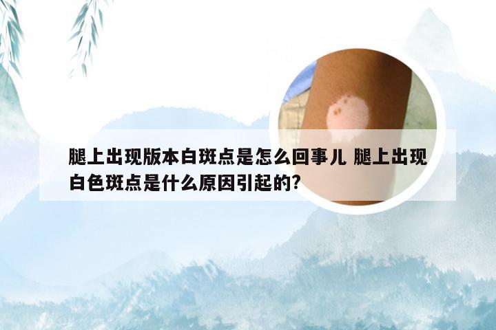 腿上出现版本白斑点是怎么回事儿 腿上出现白色斑点是什么原因引起的?