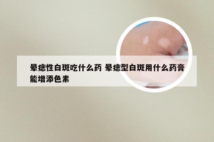 晕痣性白斑吃什么药 晕痣型白斑用什么药膏能增添色素