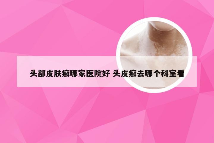 头部皮肤癣哪家医院好 头皮癣去哪个科室看