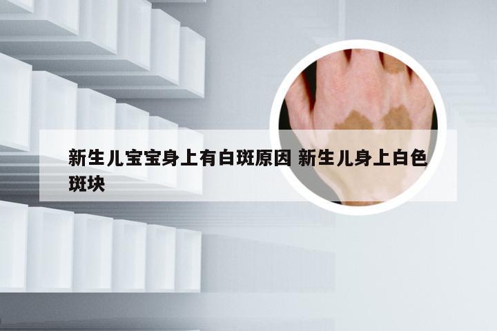 新生儿宝宝身上有白斑原因 新生儿身上白色斑块