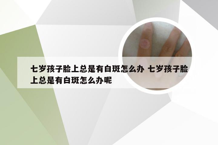七岁孩子脸上总是有白斑怎么办 七岁孩子脸上总是有白斑怎么办呢