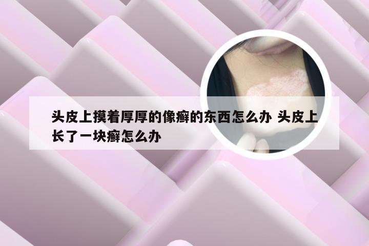 头皮上摸着厚厚的像癣的东西怎么办 头皮上长了一块癣怎么办