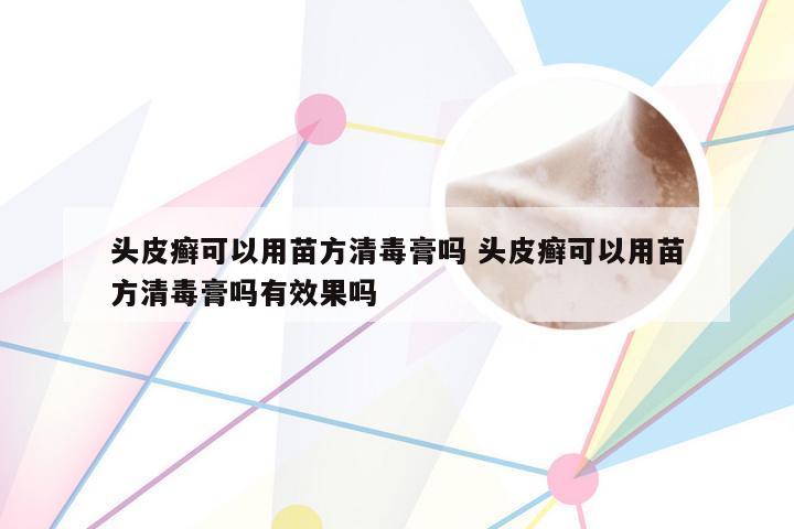 头皮癣可以用苗方清毒膏吗 头皮癣可以用苗方清毒膏吗有效果吗