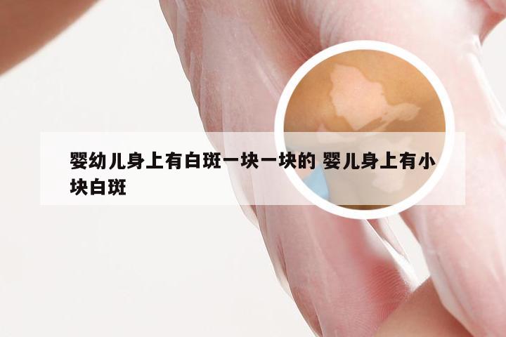 婴幼儿身上有白斑一块一块的 婴儿身上有小块白斑