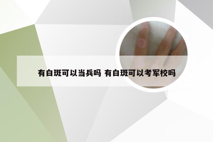 有白斑可以当兵吗 有白斑可以考军校吗