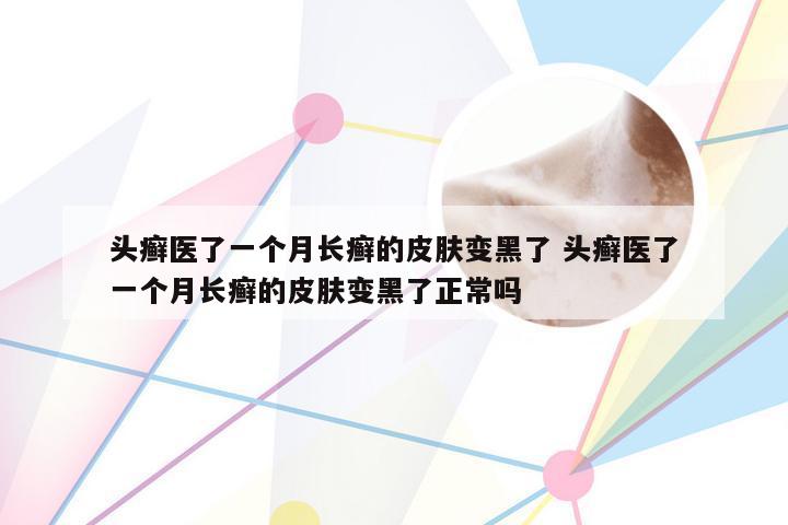 头癣医了一个月长癣的皮肤变黑了 头癣医了一个月长癣的皮肤变黑了正常吗