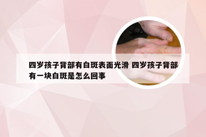 四岁孩子背部有白斑表面光滑 四岁孩子背部有一块白斑是怎么回事