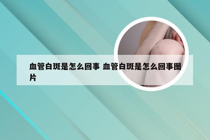 血管白斑是怎么回事 血管白斑是怎么回事图片