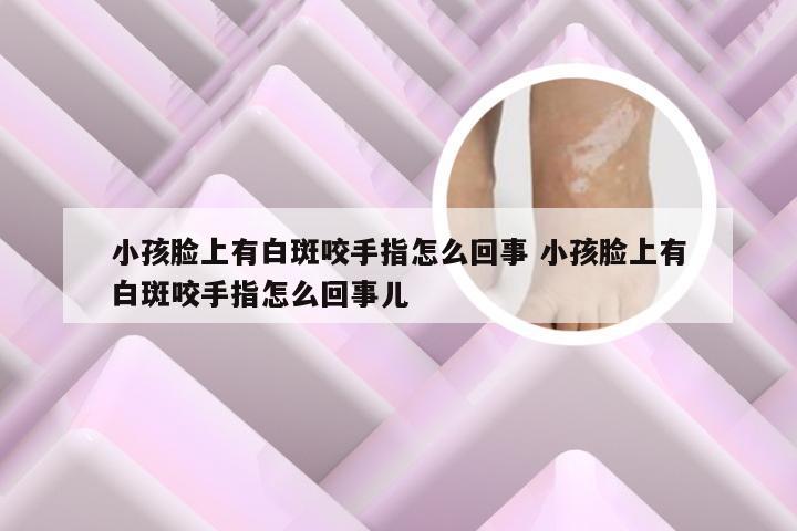 小孩脸上有白斑咬手指怎么回事 小孩脸上有白斑咬手指怎么回事儿