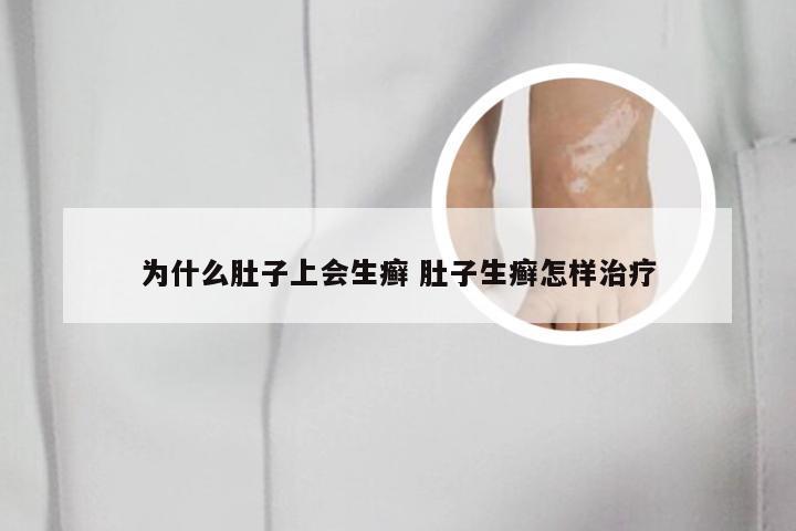 为什么肚子上会生癣 肚子生癣怎样治疗
