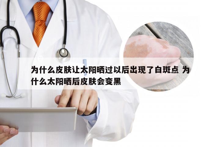 为什么皮肤让太阳晒过以后出现了白斑点 为什么太阳晒后皮肤会变黑
