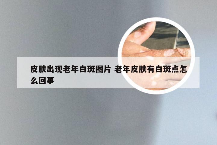 皮肤出现老年白斑图片 老年皮肤有白斑点怎么回事