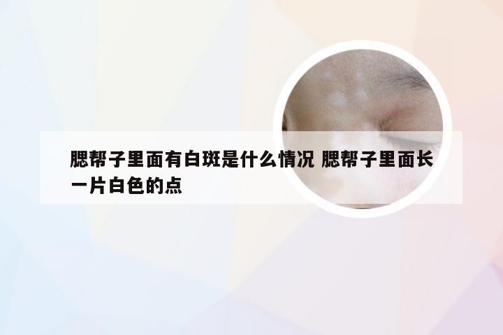 腮帮子里面有白斑是什么情况 腮帮子里面长一片白色的点