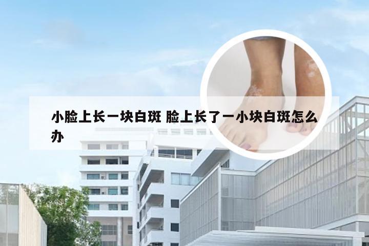 小脸上长一块白斑 脸上长了一小块白斑怎么办