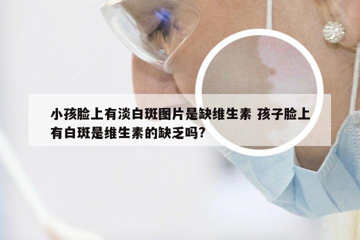 小孩脸上有淡白斑图片是缺维生素 孩子脸上有白斑是维生素的缺乏吗?