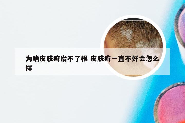 为啥皮肤癣治不了根 皮肤癣一直不好会怎么样