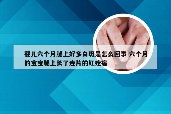 婴儿六个月腿上好多白斑是怎么回事 六个月的宝宝腿上长了连片的红疙瘩