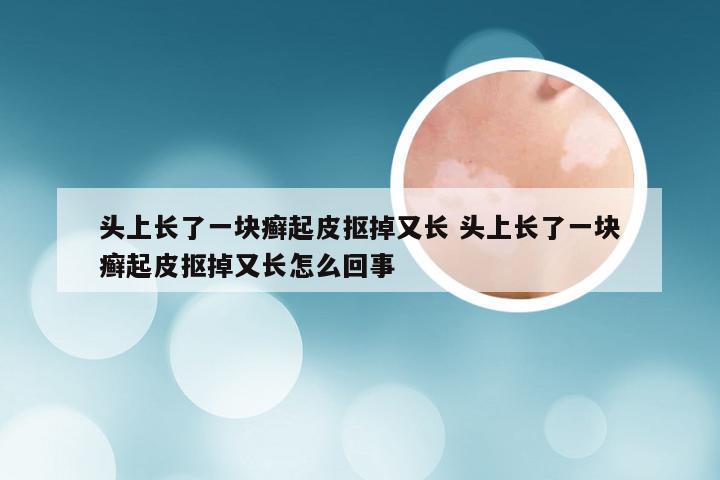头上长了一块癣起皮抠掉又长 头上长了一块癣起皮抠掉又长怎么回事