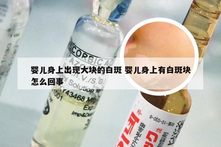 婴儿身上出现大块的白斑 婴儿身上有白斑块怎么回事