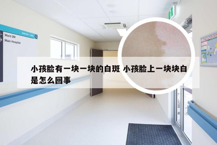 小孩脸有一块一块的白斑 小孩脸上一块块白是怎么回事