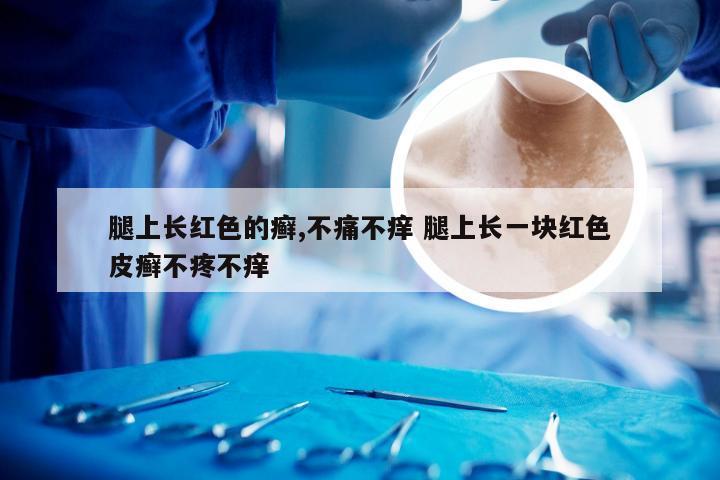 腿上长红色的癣,不痛不痒 腿上长一块红色皮癣不疼不痒