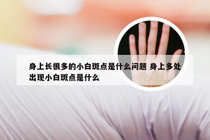 身上长很多的小白斑点是什么问题 身上多处出现小白斑点是什么