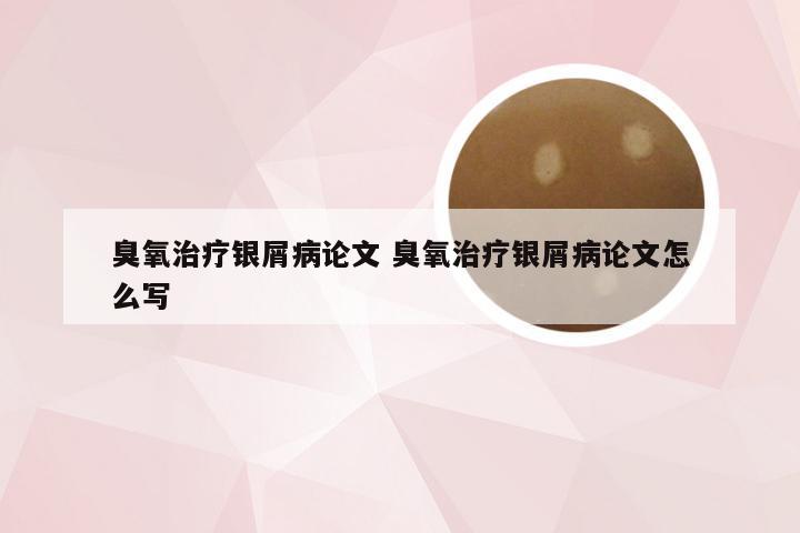 臭氧治疗银屑病论文 臭氧治疗银屑病论文怎么写