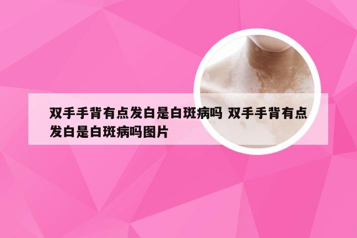 双手手背有点发白是白斑病吗 双手手背有点发白是白斑病吗图片