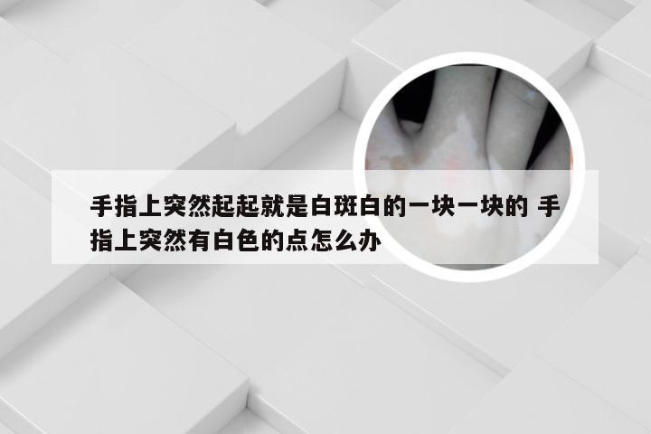 手指上突然起起就是白斑白的一块一块的 手指上突然有白色的点怎么办