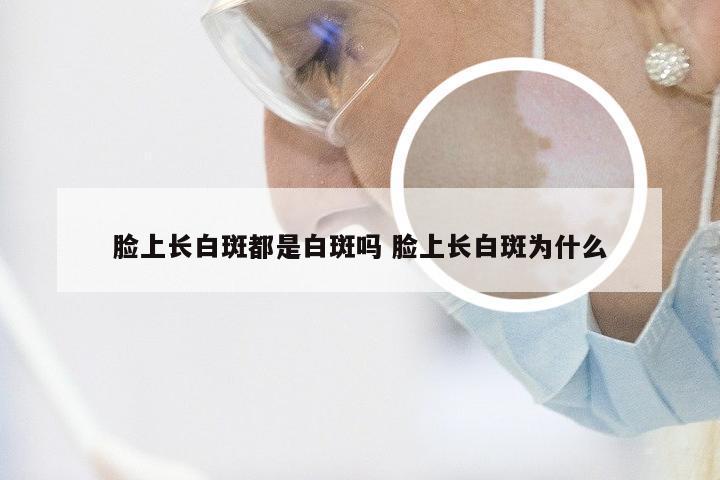 脸上长白斑都是白斑吗 脸上长白斑为什么