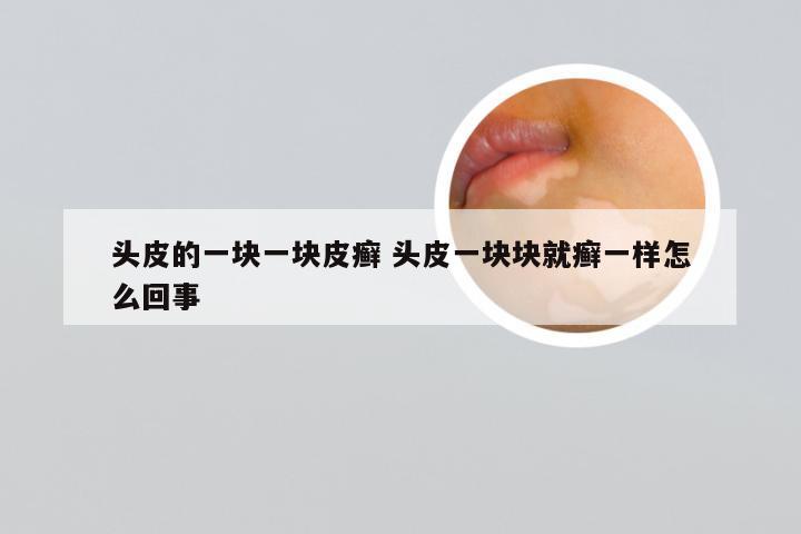 头皮的一块一块皮癣 头皮一块块就癣一样怎么回事