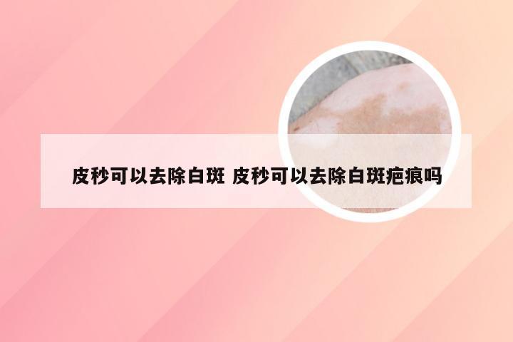 皮秒可以去除白斑 皮秒可以去除白斑疤痕吗