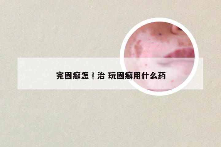 完固癣怎麼治 玩固癣用什么药