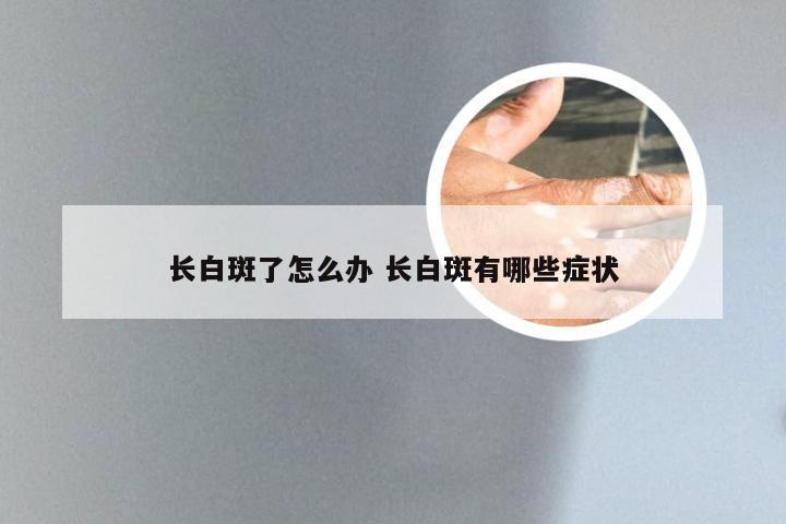 长白斑了怎么办 长白斑有哪些症状