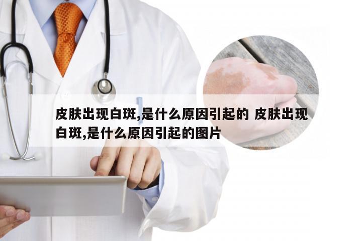 皮肤出现白斑,是什么原因引起的 皮肤出现白斑,是什么原因引起的图片