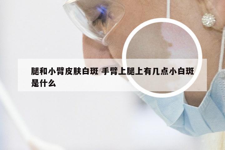 腿和小臂皮肤白斑 手臂上腿上有几点小白斑是什么