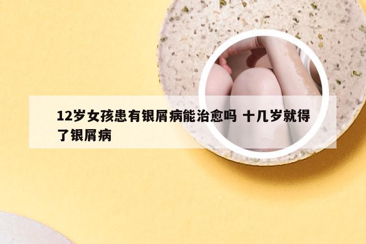 12岁女孩患有银屑病能治愈吗 十几岁就得了银屑病
