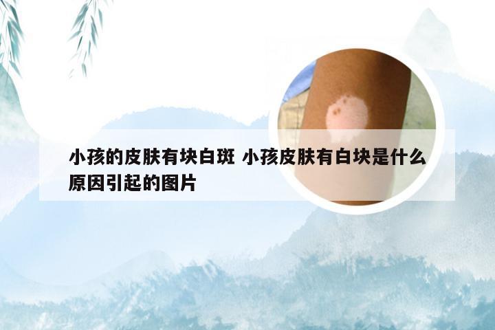 小孩的皮肤有块白斑 小孩皮肤有白块是什么原因引起的图片