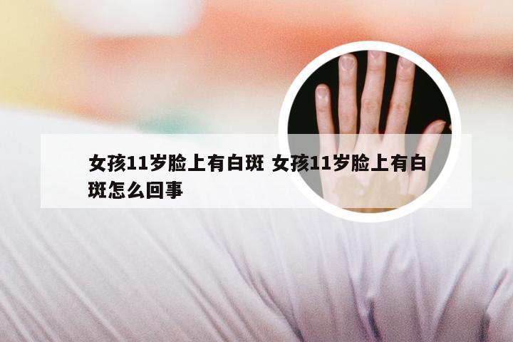女孩11岁脸上有白斑 女孩11岁脸上有白斑怎么回事