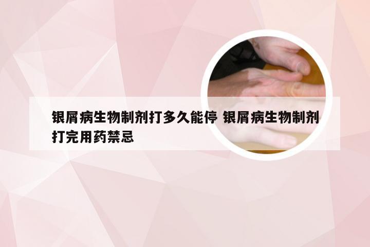 银屑病生物制剂打多久能停 银屑病生物制剂打完用药禁忌