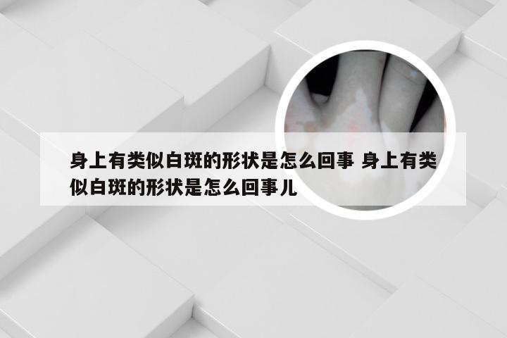 身上有类似白斑的形状是怎么回事 身上有类似白斑的形状是怎么回事儿