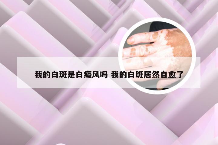 我的白斑是白癜风吗 我的白斑居然自愈了