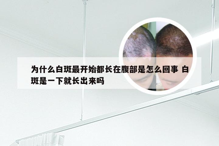 为什么白斑最开始都长在腹部是怎么回事 白斑是一下就长出来吗