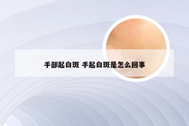 手部起白斑 手起白斑是怎么回事