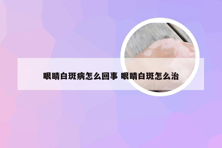 眼睛白斑病怎么回事 眼睛白斑怎么治